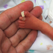 Was Your Premature Baby Harmed by Formula? Understanding NEC Lawsuits in Alabama